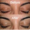 Amazing skin care tips after threading face 